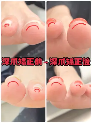 ショート ネイル RIONnail(リオンネイル)所属・RIONnail Yurikaのネイルデザイン