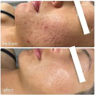 eyebrow design Arce.所属・山本 克輝の眉毛・アイブロウイメージ