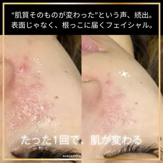 NANI OAFU所属・NANIOAFU [なんば店］のエステ・リラクイメージ