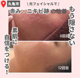 【LEPUS】 sekiのエステ・リラクイメージ