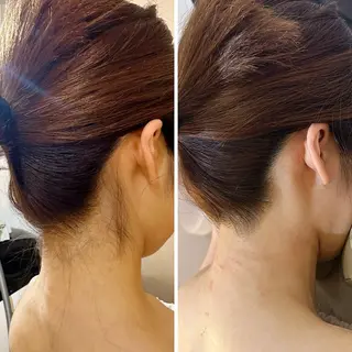 うなじ脱毛/美肌脱毛 LABELのエステ・リラクイメージ