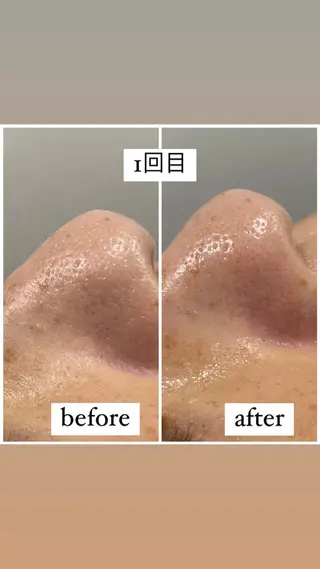 アルカンジュ~archange~所属・痩身/毛穴洗浄/脱毛 アルカンジュのエステ・リラクイメージ