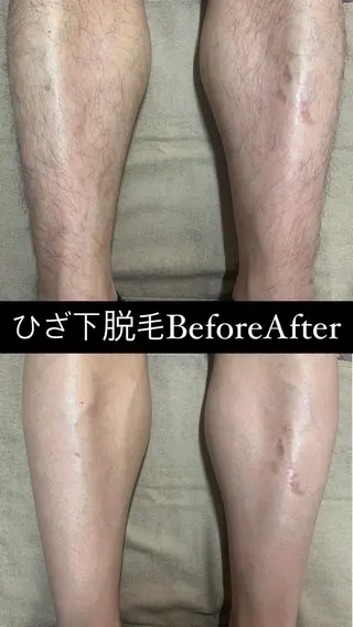 Lilyboo 池袋のエステ・リラクイメージ