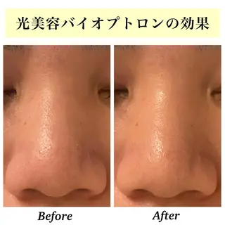 Bellesthe (ベルエステ)のエステ・リラクイメージ