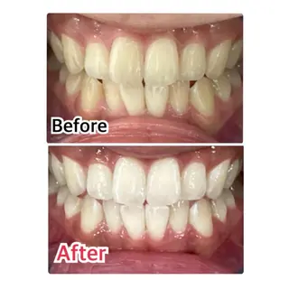 カラー メンズ キッズ マツエク・マツパ プラチナムビューティー柏所属・【歯科提携】柏ホワイ トニングスタイルのその他イメージ