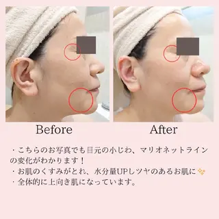 PRETTIEST SHINE所属・山田 浩子のエステ・リラクイメージ