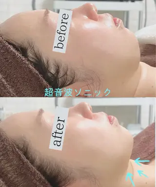 脱毛/毛穴ケア/小顔 博多アンドナイン平尾の眉毛・アイブロウイメージ