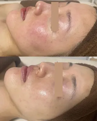 salon More所属・出口 玲菜のエステ・リラクイメージ