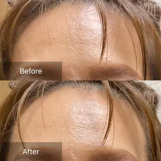 産毛専門店 Bittoのエステ・リラクイメージ