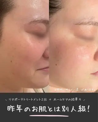 Re:Belle所属・Re:Belle 久留米 : 中島のエステ・リラクイメージ