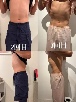 メンズ 腸活サポート みなみののエステ・リラクイメージ