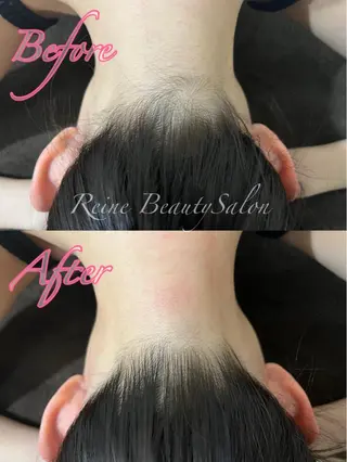 Reine BeautySalon所属・毛穴/シミ肝斑/脱毛 横山梨里のエステ・リラクイメージ