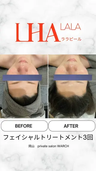 WARCH Marieのその他イメージ