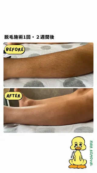 yellow.所属・yellow💛【 脱毛&フェイシャル】のエステ・リラクイメージ