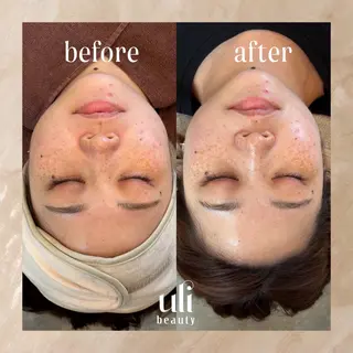 uli beauty所属・韓国肌管理サロン ulibeautyのエステ・リラクイメージ