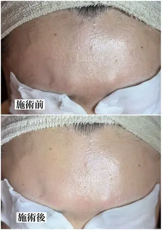 マツヤニWax専門/ 岸和田/Luanaのエステ・リラクイメージ