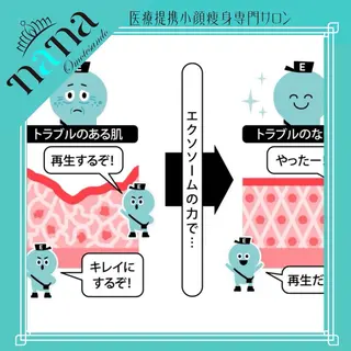小顔痩身インディバ Nana表参道のエステ・リラクイメージ