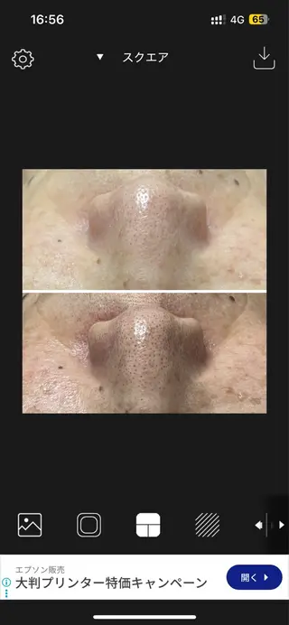 shaving room 晴のエステ・リラクイメージ