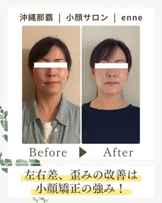 小顔サロンenne所属・小顔サロンenne 【エンネ】のその他イメージ