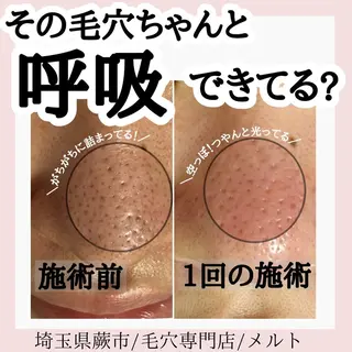 C. Lのマツエク・マツパデザイン