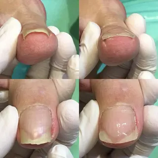 ネイル 東京巻き爪アカデミー所属・東京巻き爪 アカデミーのエステ・リラクイメージ