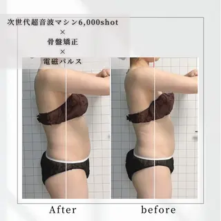 小顔矯正専門店 【RED】池田のエステ・リラクイメージ