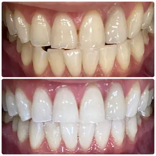 ホワイトニングルーム　川崎店所属・ホワイトニング ルーム　川崎店のその他イメージ