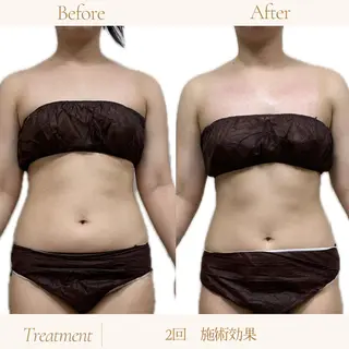 coco salon sou.所属・佐藤 由依のエステ・リラクイメージ