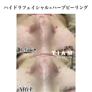 美肌サロンTIAM by tetoteのエステ・リラクイメージ