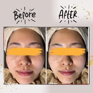 ピーリング専門店 Belluteのエステ・リラクイメージ