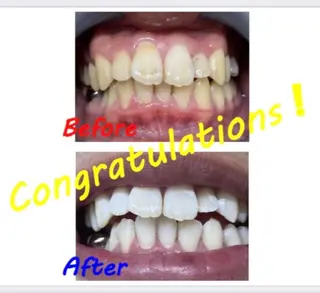 セルフホワイトニングサロン　ラヴィアン所属・ホワイトニングサロン La vie enのその他イメージ