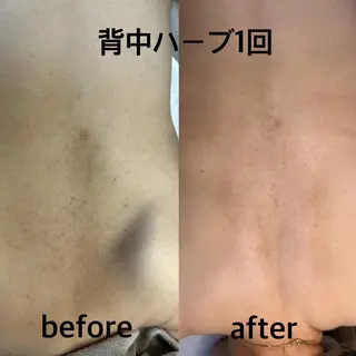 脱毛・眉毛・フェイス サロンN久留米店のエステ・リラクイメージ