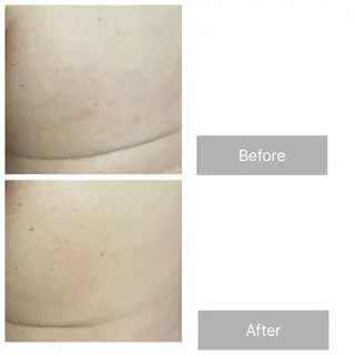 メンズ エマニエル USAのエステ・リラクイメージ