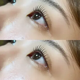 ใใใจใฏใปใใใ ๐๐๐๐๐ ๆ่ฑใฎใใใจใฏใปใใใใใถใคใณ