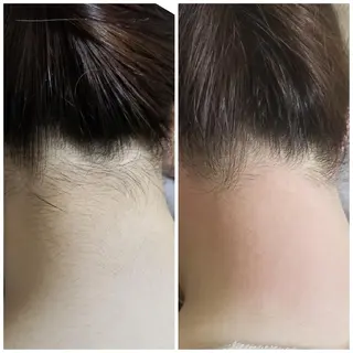 A*[エースター] シュガーリング🍋のエステ・リラクイメージ