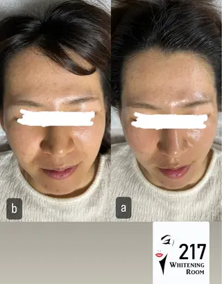 217whitening  room所属・217 ホワイトニングルームのエステ・リラクイメージ
