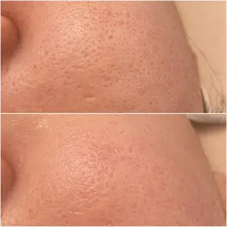 ✨美肌水光✨ アトリエリュバンのエステ・リラクイメージ