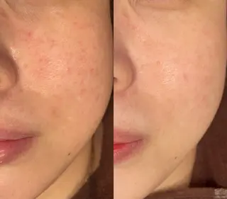 お肌のかかりつけサロンP.A.L.M.所属・【P.A.L.M.】 むき卵×毛穴レス肌のエステ・リラクイメージ