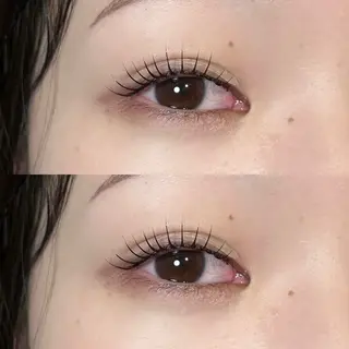 ใใใจใฏใปใใใ ๐๐๐๐๐ ๆ่ฑใฎใใใจใฏใปใใใใใถใคใณ