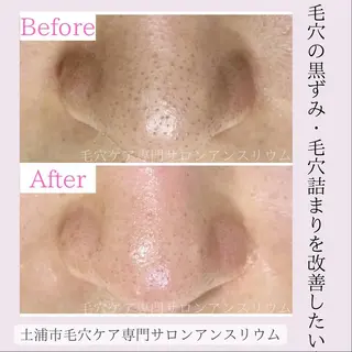 毛穴ケア専門サロンアンスリウム所属・茨城土浦 つくば毛穴 ケア専門サロンのエステ・リラクイメージ