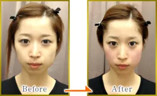 美容鍼灸サロン LOMIHARIのエステ・リラクイメージ