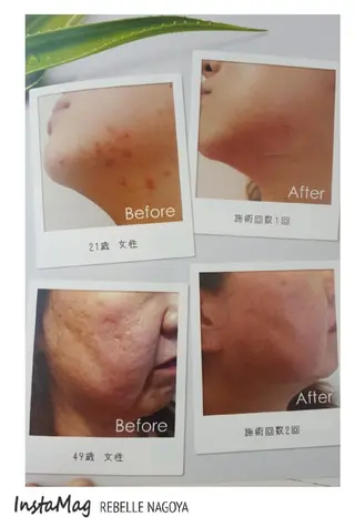 マツエク・マツパ ネイル パーマ ミディアム カラー キッズ メンズ 次世代まつげパーマは 『リベル名古屋』のマツエク・マツパデザイン