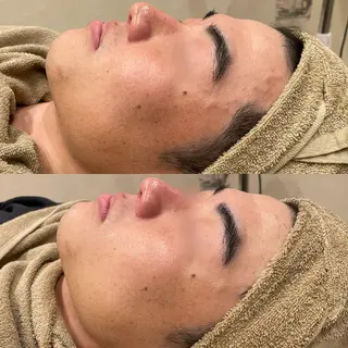 Re:Belle所属・Re:Belle 久留米 : 中島のエステ・リラクイメージ