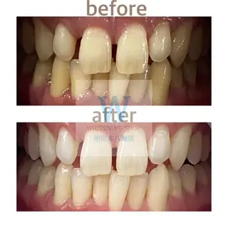 ホワイトニング ショップ本八幡店のエステ・リラクイメージ