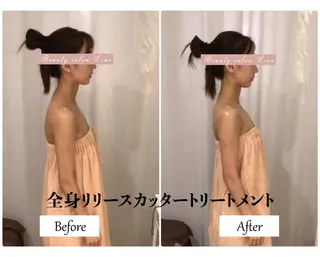 痩身×フェイシャル ブライダル|Linoのエステ・リラクイメージ