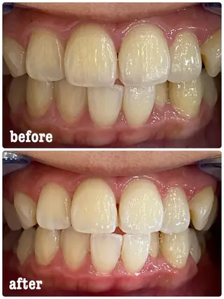 ホワイトニングサロン ラウレアのその他イメージ