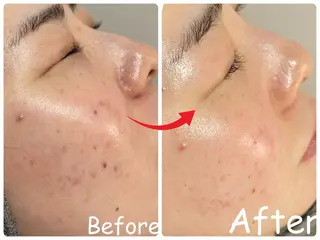 ele"ハーブ ピーリング 専門店のエステ・リラクイメージ