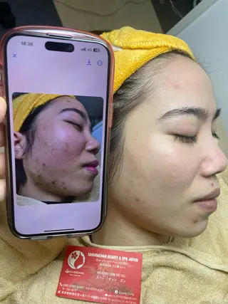 ニキビ、痩身、脱毛、 サクラチャンスパのエステ・リラクイメージ