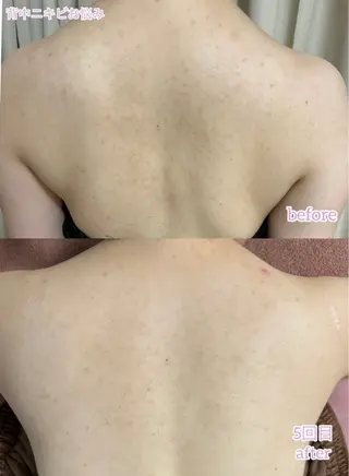 透明感の肌Lino malieのエステ・リラクイメージ