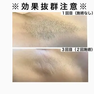 美肌コラーゲン脱毛SINCERITE【サンセリテ】所属・瀬野 のぞみのエステ・リラクイメージ